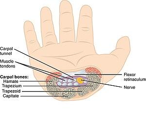 thumbnail of dbpedia resource