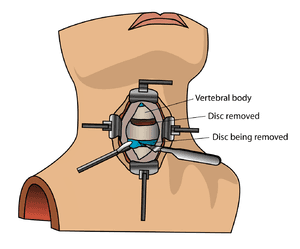 thumbnail of dbpedia resource