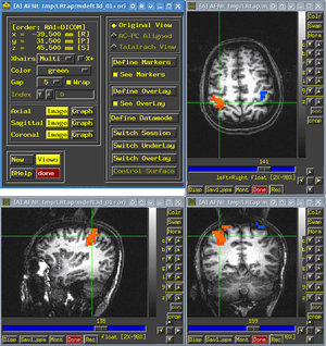 thumbnail of dbpedia resource