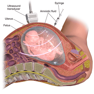 thumbnail of dbpedia resource