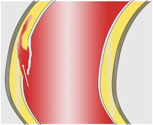 thumbnail of dbpedia resource