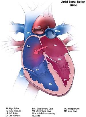 thumbnail of dbpedia resource