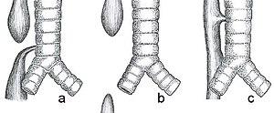 thumbnail of dbpedia resource