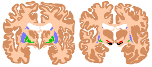 thumbnail of dbpedia resource