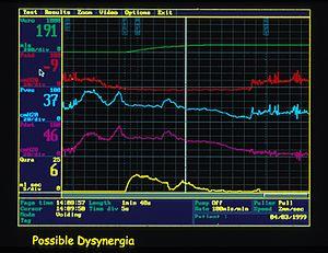 thumbnail of dbpedia resource