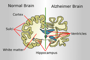 thumbnail of dbpedia resource