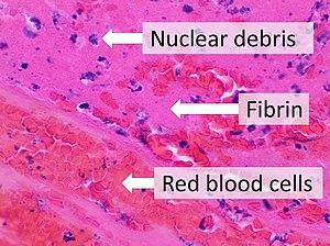 thumbnail of dbpedia resource