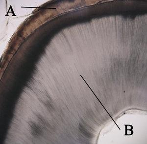 thumbnail of dbpedia resource