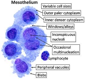 thumbnail of dbpedia resource