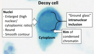 thumbnail of dbpedia resource