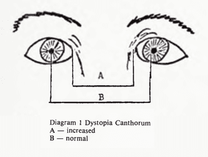 thumbnail of dbpedia resource