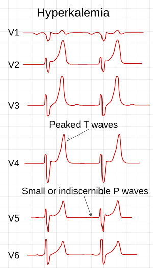 thumbnail of dbpedia resource