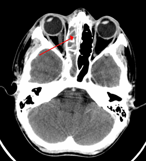 thumbnail of dbpedia resource