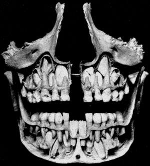 thumbnail of dbpedia resource