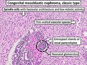 thumbnail of dbpedia resource