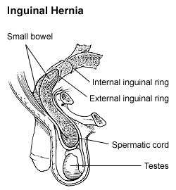 thumbnail of dbpedia resource