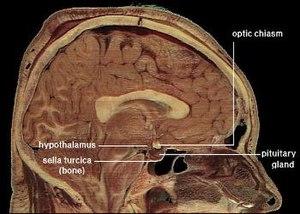 thumbnail of dbpedia resource