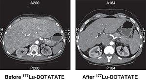 thumbnail of dbpedia resource