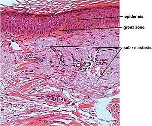 thumbnail of dbpedia resource