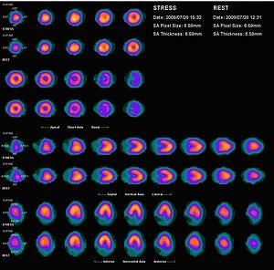 thumbnail of dbpedia resource