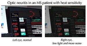 thumbnail of dbpedia resource