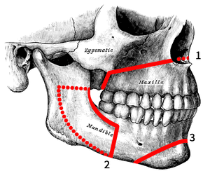 thumbnail of dbpedia resource