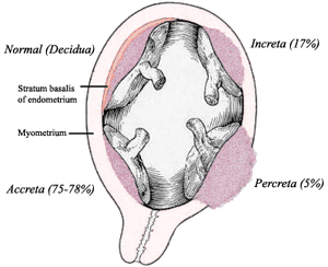 thumbnail of dbpedia resource