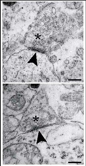 thumbnail of dbpedia resource