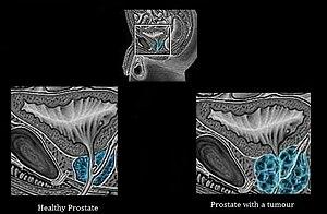 thumbnail of dbpedia resource