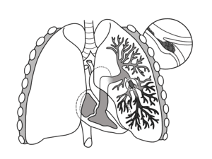 thumbnail of dbpedia resource