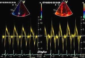 thumbnail of dbpedia resource