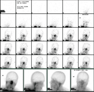 thumbnail of dbpedia resource