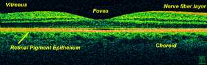 thumbnail of dbpedia resource