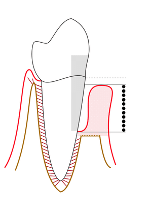 thumbnail of dbpedia resource