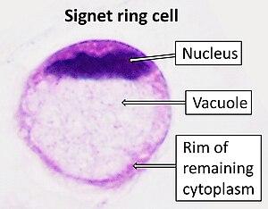 thumbnail of dbpedia resource