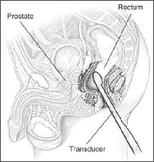 thumbnail of dbpedia resource