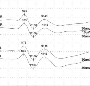 thumbnail of dbpedia resource