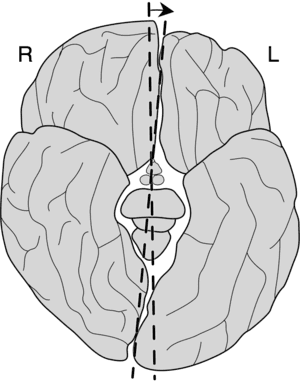 thumbnail of dbpedia resource