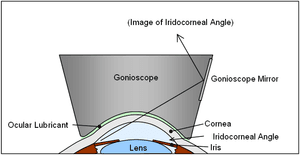 thumbnail of dbpedia resource